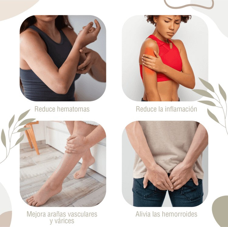Naturhof Crema de Castaño de Indias 250 ml – Cuidado Natural para la Piel y la Circulación
